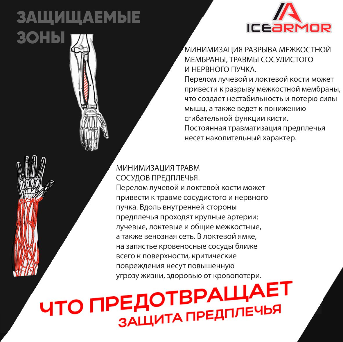 Защита запястья игрока Ice Armor